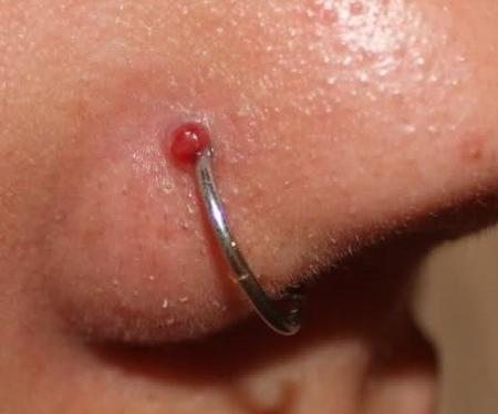 Risk Of Double Nose Piercing