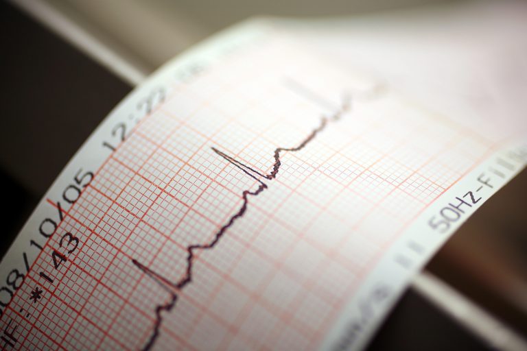 How to Become an Echocardiogram Technician