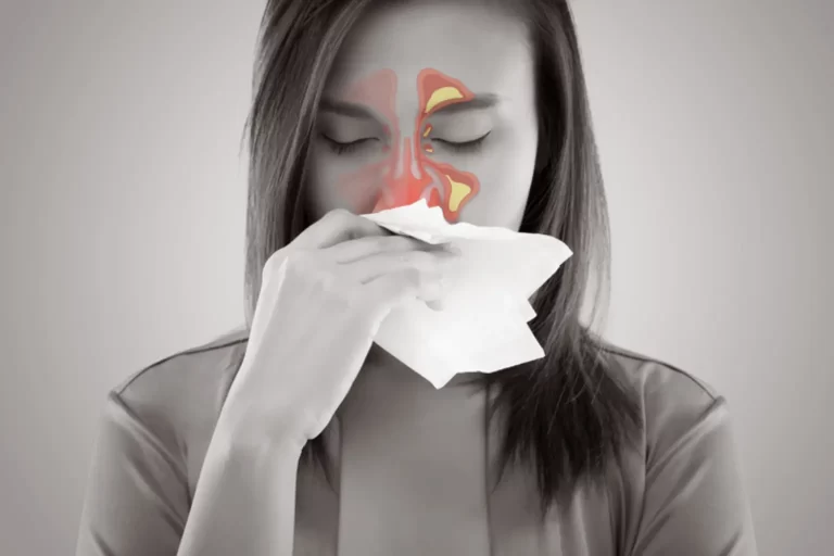 Are Sinus Infections Contagious: Discover In 8 Crucial Steps